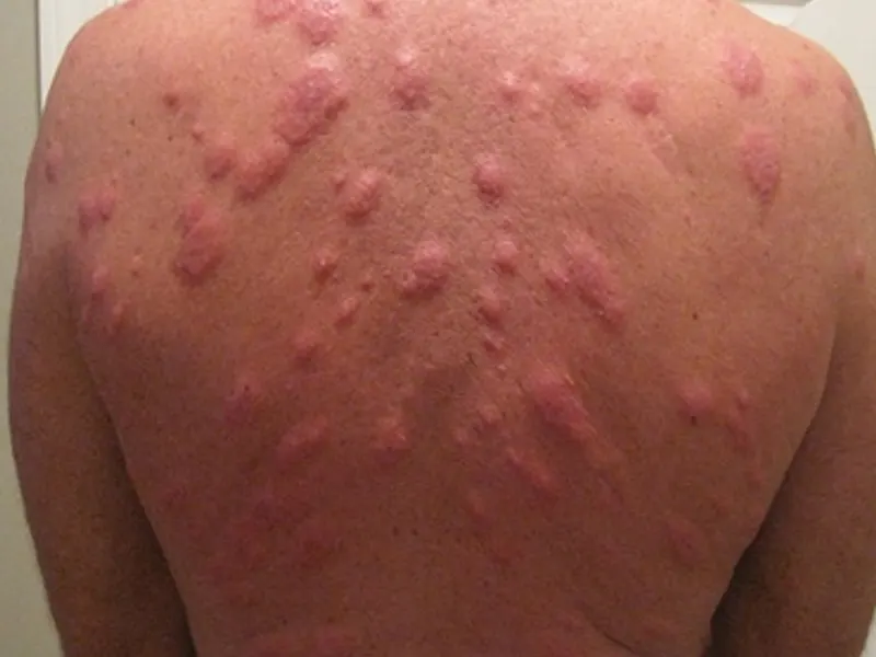 Disinfestazione cimici da letto: segnali di infestazione